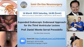 İON 429 Lecture Prevedello Expanded Endoscopic Endonasal Approach for the 3rd Ventricular Lesions [upl. by Ettelocin]