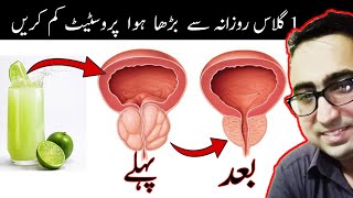 Drink 1 Cup EVERYDAY To Shrink An ENLARGED Prostate  BPH  Dr Javaid Khan [upl. by Yoshio]