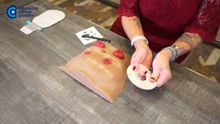 How to Cut and Fit an Ostomy Wafer for a Stoma [upl. by Ardehs434]