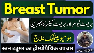 Breast Tumor بریسٹ ٹیومر स्तन ट्यूमर Homeopathic Treatment in Urdu  Hindi [upl. by Oskar]