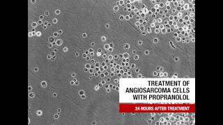 Treatment of Angiosarcoma Cells With Propranolol [upl. by Jahdol]