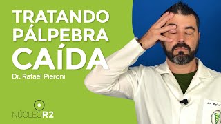 Exercícios para Pálpebra Caída  Possíveis sequelas de Paralisia Facial Paralisia de Bell [upl. by Semreh]