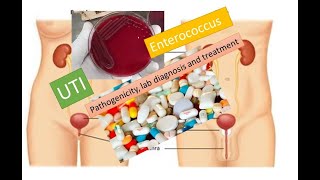 Enterococus pathogenecity lab diagnosis and treatment [upl. by Eiddal844]