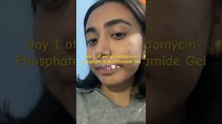 Using Clindamycin Phosphate amp Nicotinamide Gel girls skincare acne [upl. by Kisor]