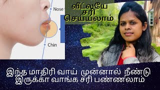 How to get rid of protruding mouth and lips naturally  வீட்லயே வாய் நீளமாய் இருப்பதை சரியாக்கலாம் [upl. by Stutzman]