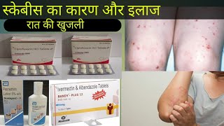 scabies ka treatment symptomsscabies treatment in hindi स्केबीज का इलाज लक्षण ट्रीटमेंट [upl. by Martsen]