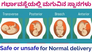 Baby positions During Pregnancy Position for Normal delivery pregnancy tipsAayushi RS [upl. by Siugram]