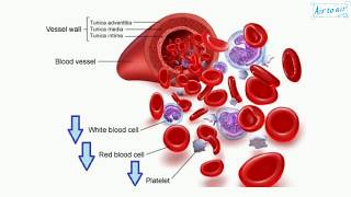 pancytopenia English  Medical terminology for medical students [upl. by Ace750]