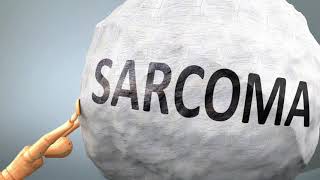 How are Sarcomas Diagnosed [upl. by Llegna]