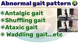 Abnormal gait pattern scissors gait  Antalgic gait  shuffling gait  Ataxic gait pattern [upl. by Leeland367]