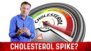 Intermittent Fasting and Ketosis May Spike Your Cholesterol – Dr Berg [upl. by Llirrehs]