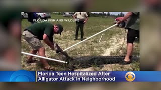 911 Call Reveals Moments After Gator Attacks Elderly Woman [upl. by Selwin352]