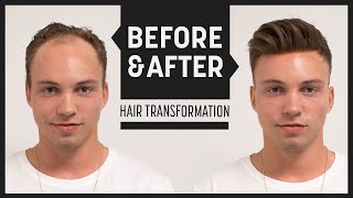 Johnny Edlind High Volume Hairstyle 2018  Transformation mit Haarsystem  Hairsystems Heydecke [upl. by Hayman]