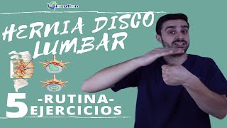 ¿Cómo reconocer si sufrimos una hernia discal lumbar [upl. by Kellina531]