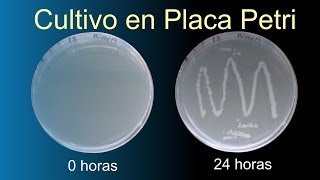 Cultivo bacteriano en placa Petri Divulgación científica IQOGCSIC [upl. by Enailil]