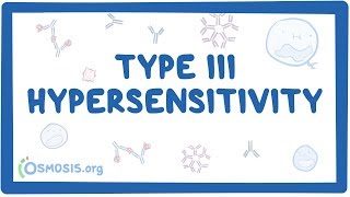 Type III hypersensitivity immune complex mediated  causes symptoms amp pathology [upl. by Aratas]