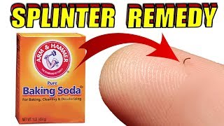 How to Remove a Splinter With Baking Soda [upl. by Snehpets]