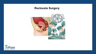 Rectocele Surgery [upl. by Eldrid]