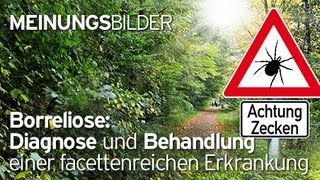 nexworldTV Borreliose Diagnose und Behandlung einer facettenreichen Erkrankung Trailer [upl. by Aerdnod]