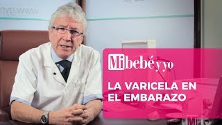 La varicela en el embarazo [upl. by Dwaine]