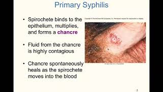 chapter 21 spirochetes and curviform Gram  microbes [upl. by Mano]