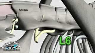 Anestesia epidural en Bovinos [upl. by Carolina]