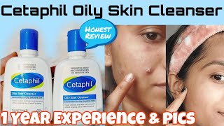 Basic Skincare Routine  Cetaphil Gentle Skin Cleanser amp Moisturizer  Non Sponsored [upl. by Whitson]