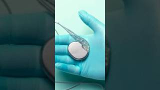 Heart Pacemaker II Pacemaker Heart II Pacemakers Explained II Pacemaker Device II How pacemaker work [upl. by Carri]