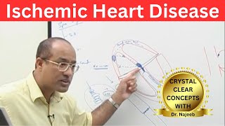 Ischemic Heart Disease  Myocardial Infarction  Cardiology🫀 [upl. by Ilamad915]