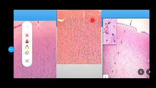 Histology Slides Series Episode 17  Histology of Nervous Tissues including Peripheral Nerves [upl. by Nnyleve]