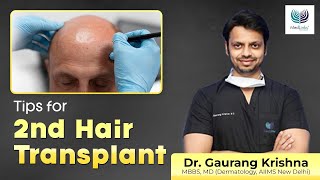 2nd Hair Transplant के समय रखें इन अहम बातों का ध्यान  Tips for 2nd Hair Transplant  Medlinks [upl. by Yeliah]