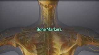 Bone Markers [upl. by Enilauqcaj938]