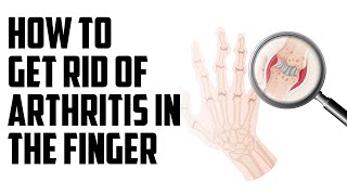 How to Stop Rheumatoid Arthritis in Your Fingers FAST [upl. by Leonelle]