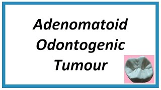 Adenomatoid Odontogenic Tumour  Important notes  Odontogenic Tumors 1  Oral Pathology [upl. by Alek]