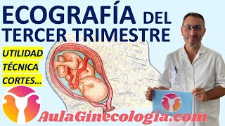 ECOGRAFÍA DEL TERCER TRIMESTRE TÉCNICA CORTE por CORTE UTILIDAD  Ginecología y Obstetricia [upl. by Ennoira585]