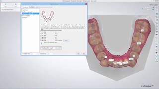 3Shape Ortho Analyzer  How to Perform a Space Analysis in Ortho Analyzer [upl. by Oiuqise]