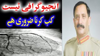 Angiography Test kab karna Zarori Haiانجیو گرافی ٹیسٹ کب کرنا ضروی ہے  By Gen Asif Ali Khan R [upl. by Elset]