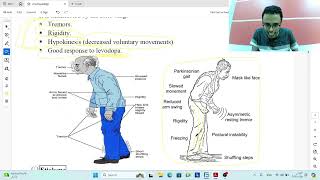 Diseases of the extra pyramidal system [upl. by Abott158]