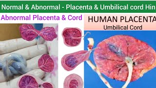 Human Placenta  Structure Function amp Abnormalities of Placenta amp Umbilical cord  Umbilical Cord [upl. by Holland]