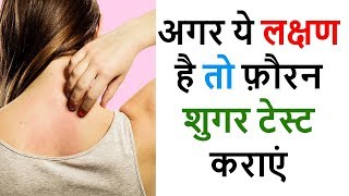 ब्लड शुगर डायबिटीज के लक्षण Diabetes Symptoms [upl. by Asilrak]