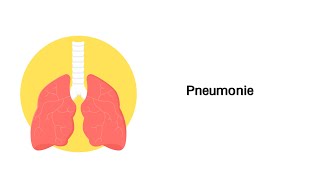 Lungenentzündung Pneumonie  Erkrankungen der Atemwege [upl. by Nagorb]