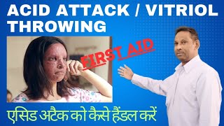 Acid attack  Vitriolage  First Aid after acid attack [upl. by Eizzo]