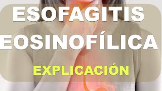 Qué es la esofagitis eosinofilica [upl. by Jew]