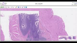 Histological description of the Ileum Peyers patches [upl. by Laflam]