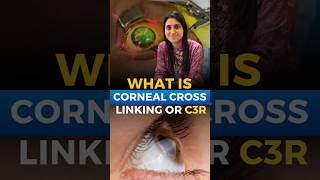 C3R Keratoconus Treatment [upl. by Hamon]