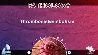 Revision of L 14 Thrombosis and embolism pathology [upl. by Leeda]