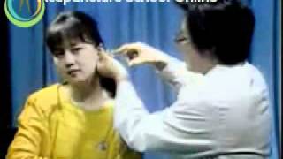 Acupuncture Video Course Lesson 22  Auricular Diagnosis And Treatment [upl. by Leduar]