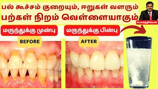 பற்கள் வெள்ளையாக  How to make tooth white  Home remedies to Heal Receding Gums and Grow Back [upl. by Yetac]