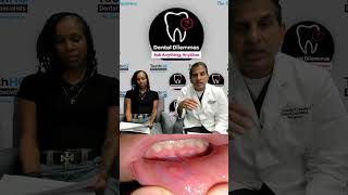 Why ulcer in your mouth turns gums to white [upl. by Nimsay]