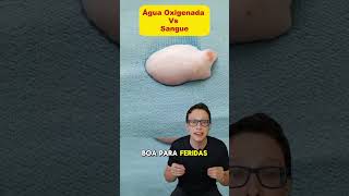 Água oxigenada X Sangue 😯🩸curiosidades medicina medico dicas experimento ciencia enfermagem [upl. by Dnalevelc]